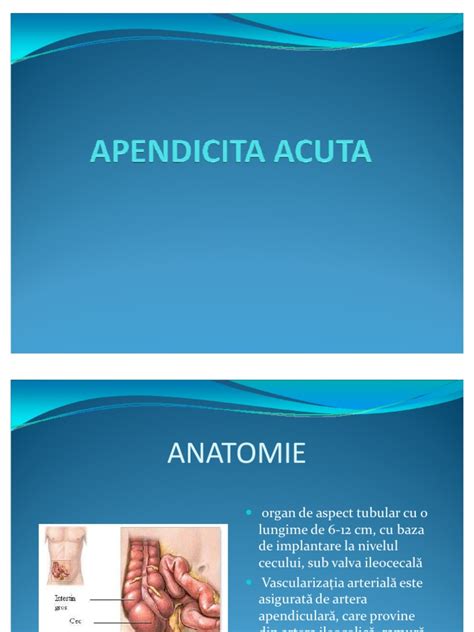 apendicita acuta|Apendicită